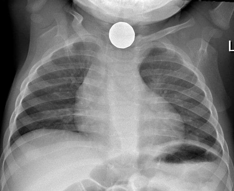 canada-Various (1987-present)-item